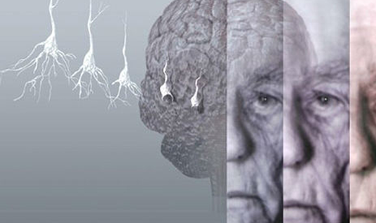 阿爾茲海默癥，了解、預(yù)防與關(guān)懷，阿爾茲海默癥，了解、預(yù)防與患者的關(guān)懷之路