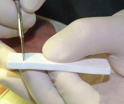 關(guān)于隆鼻材料的選擇，哪種材料最好最安全？，關(guān)于隆鼻材料的選擇，哪種材料最安全且效果最好？