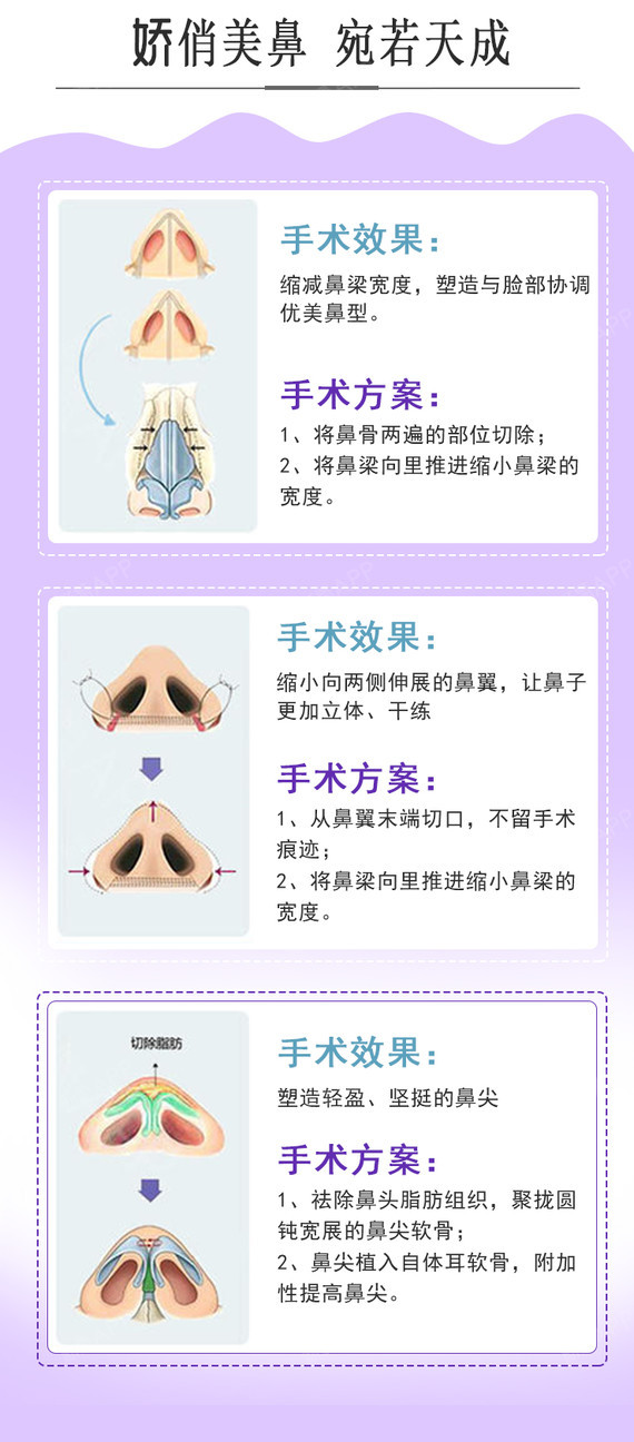 駝峰鼻矯正手術(shù)費用詳解，多少錢？，駝峰鼻矯正手術(shù)費用全面解析，手術(shù)費用究竟多少？