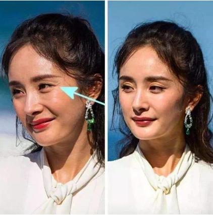 如何有效去除魚尾紋皺紋——全方位指南，全方位指南，如何有效去除魚尾紋皺紋