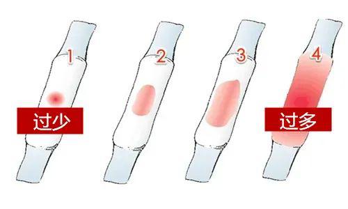 如何分辨撤退性出血和月經(jīng)，如何區(qū)分撤退性出血與月經(jīng)？