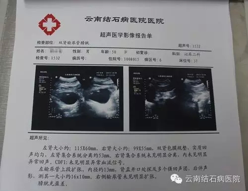 結(jié)石卡在輸尿管掉不下來怎么辦？全面解析應(yīng)對之策，結(jié)石卡在輸尿管掉不下來怎么辦？專業(yè)解析與應(yīng)對策略