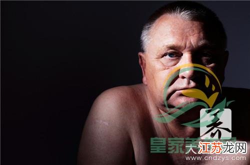 男人染上霉菌的癥狀及應(yīng)對措施，男人霉菌感染的癥狀與應(yīng)對之策