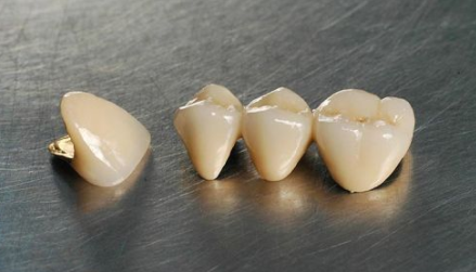 鈷鉻烤瓷牙，品質(zhì)與價(jià)值并存，僅需200元一顆的優(yōu)質(zhì)選擇，鈷鉻烤瓷牙，優(yōu)質(zhì)選擇，價(jià)值僅需200元一顆